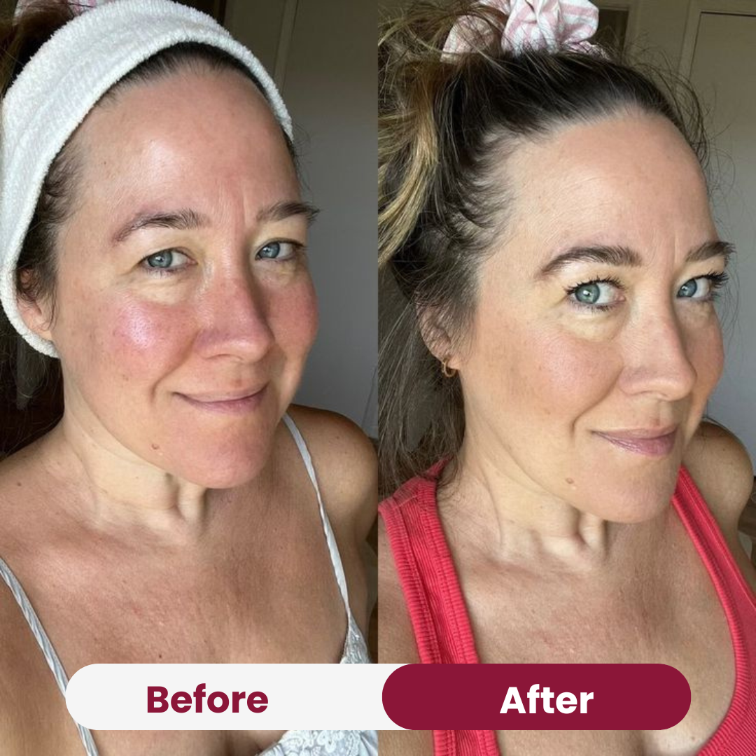 Anti-Wrinkle Collagen Mask Free