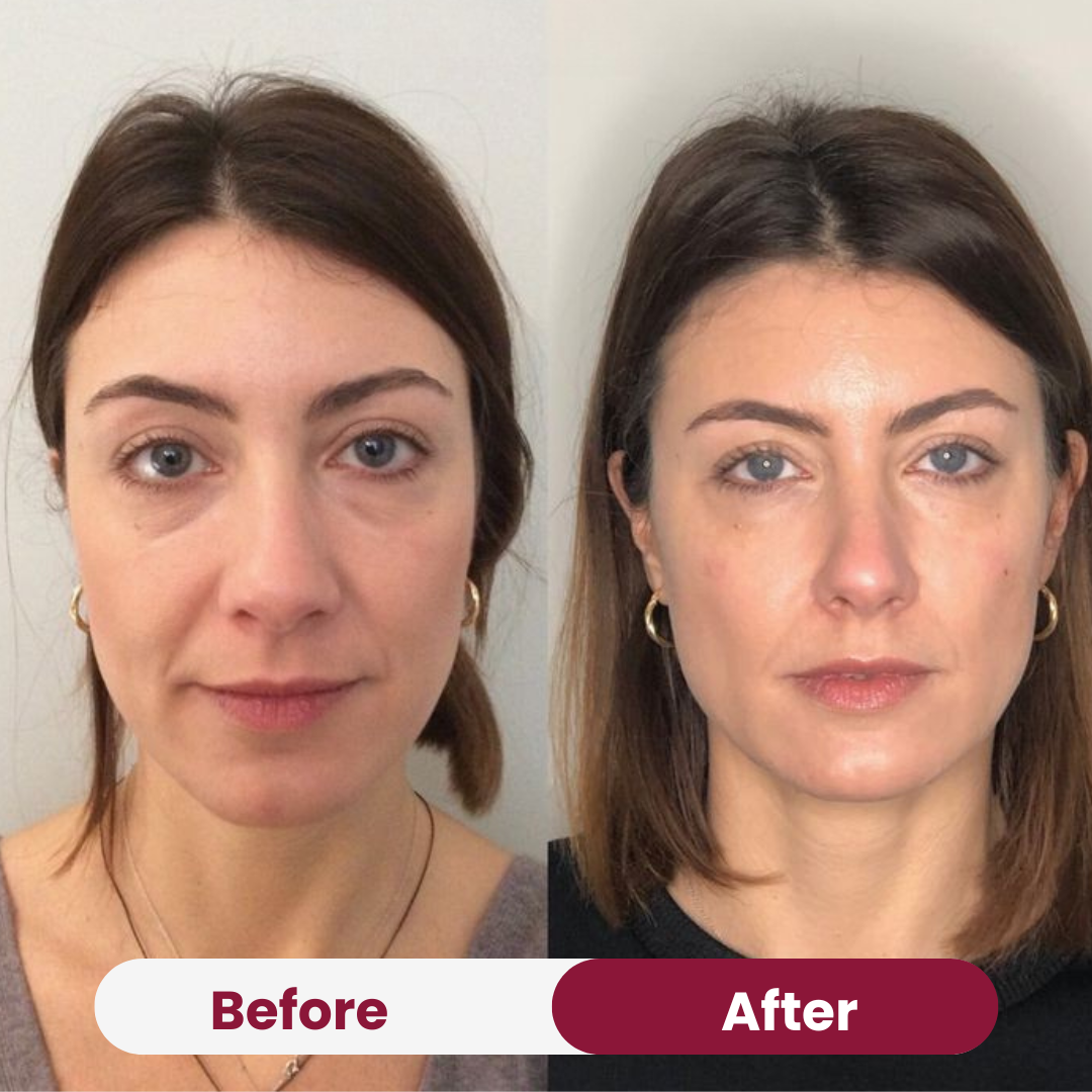 Anti-Wrinkle Collagen Mask Free