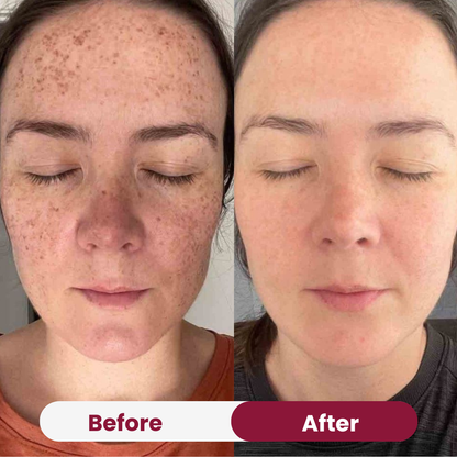 Anti-aging Niacimide 10+ Serum