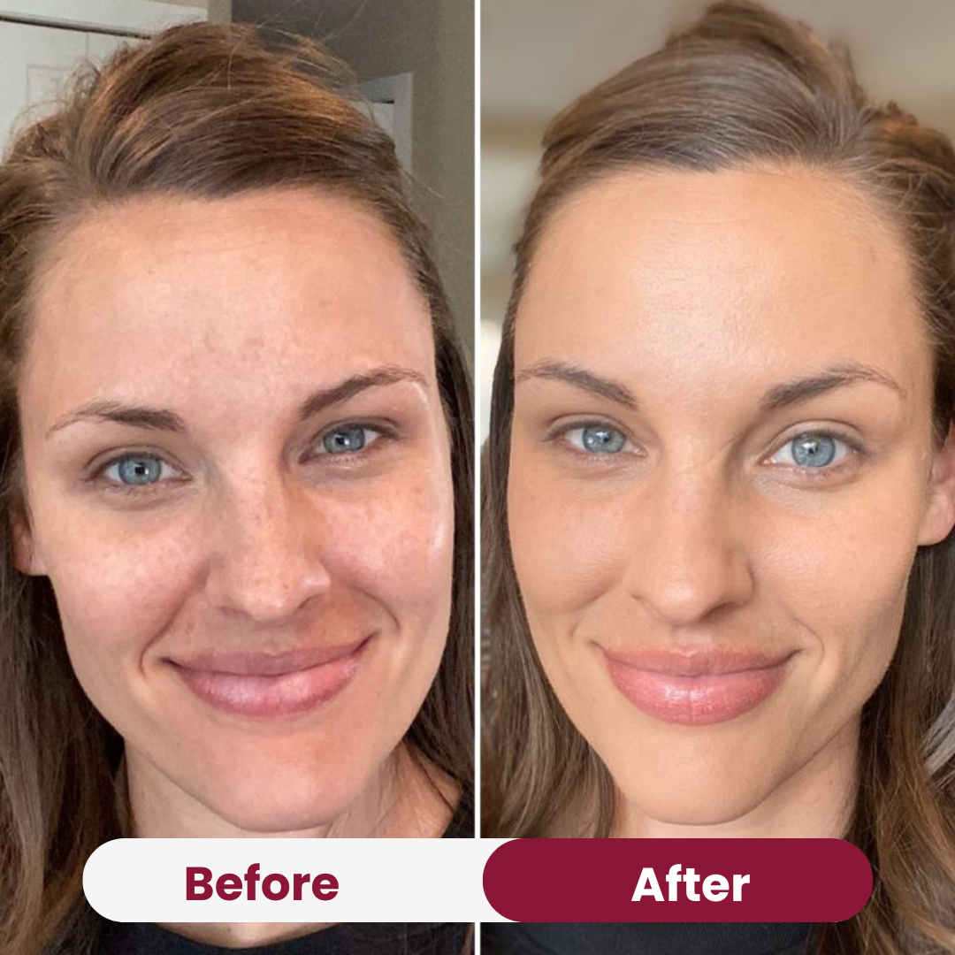 Anti-Wrinkle Collagen Mask Free