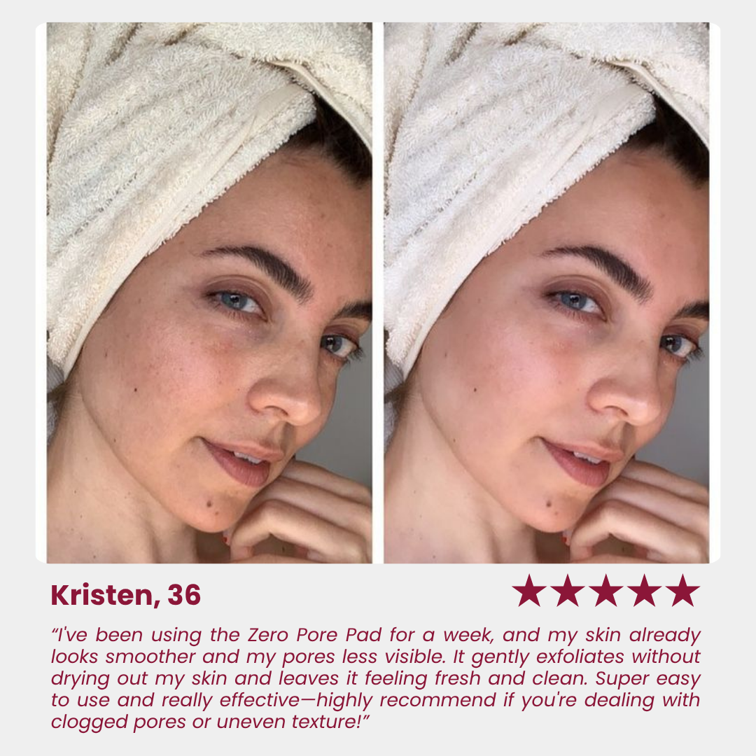 Zero Pore Pad