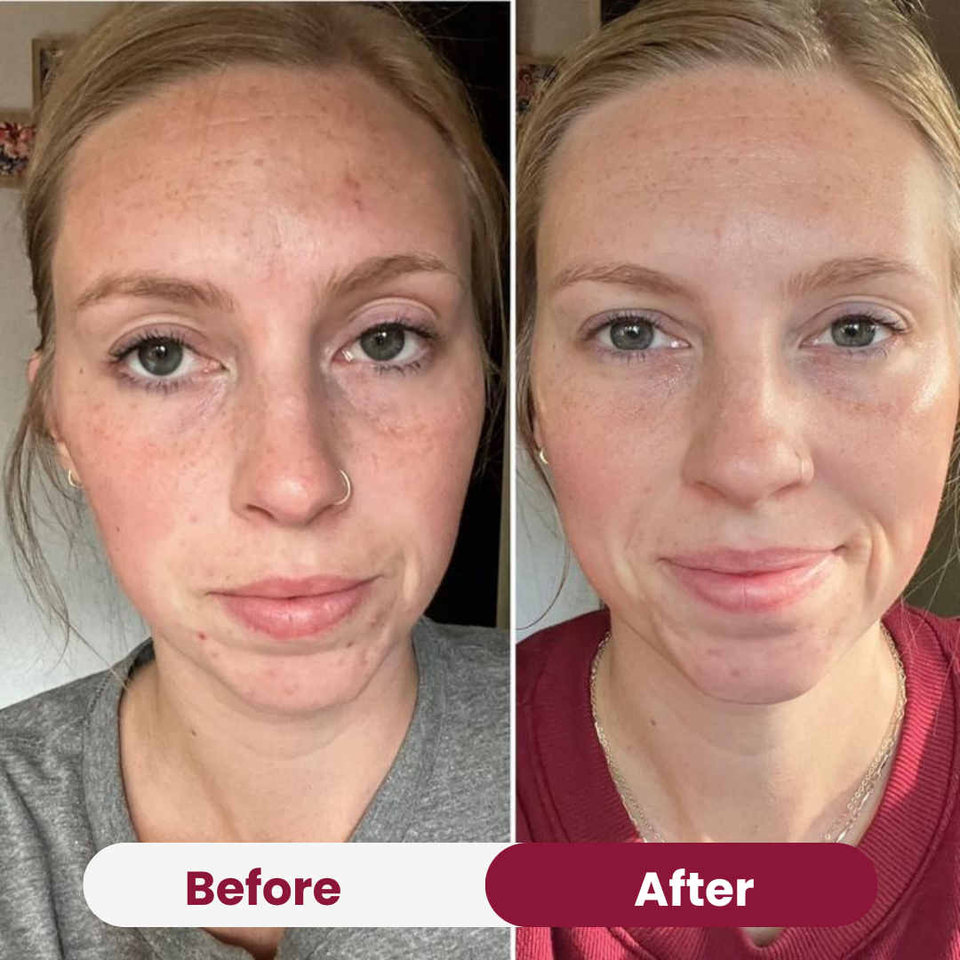 Radiant Niacinamide Real Deep Mask