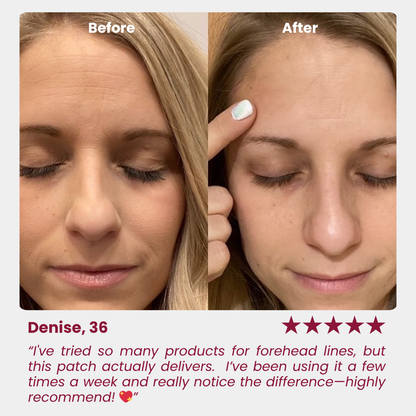 Wrinkle Forehead Patch