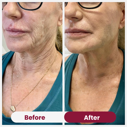 Valentine's Lift & Glow Bundle