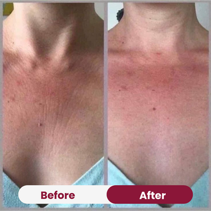 Chest Anti-Wrinkle Patch