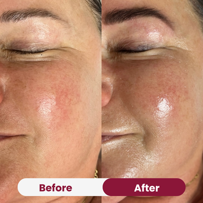 Collagen Wrapping Mask