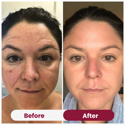 Collagen Wrapping Mask