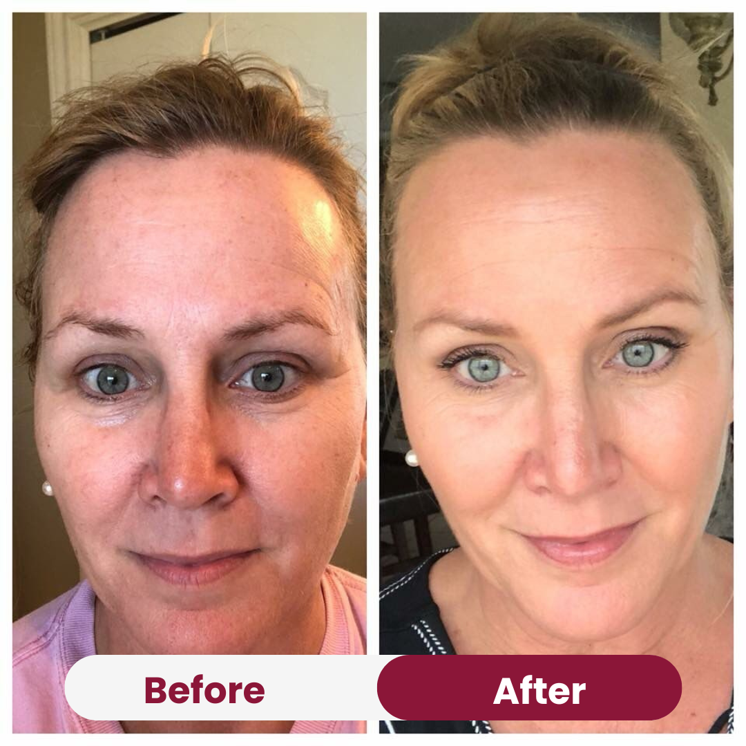 Multi-Collagen Capsules