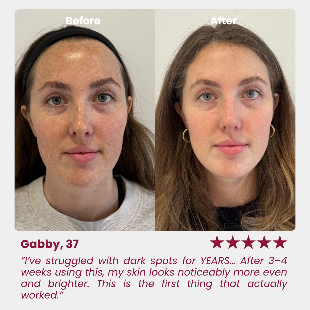 Anti-aging Niacimide 10+ Serum