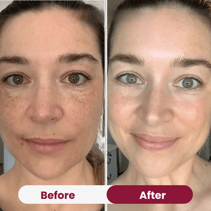 Bio-Collagen Mask