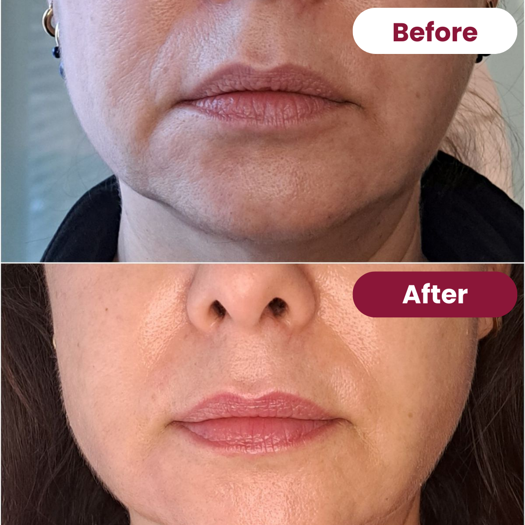 Collagen Mouth Tape