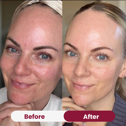 Anti-aging Niacimide 10+ Serum