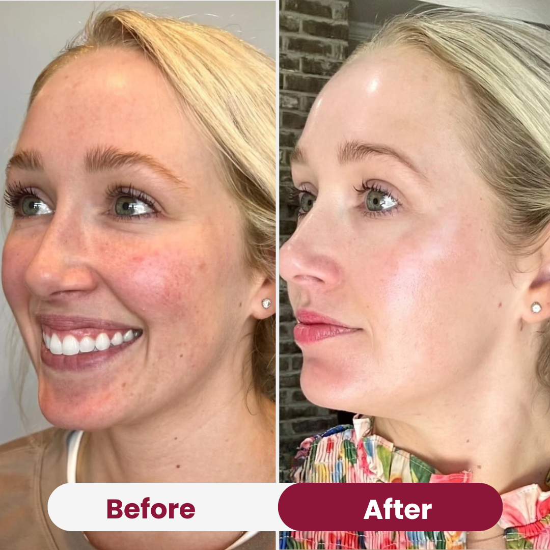 Hydro Cera-Nol Collagen Mask