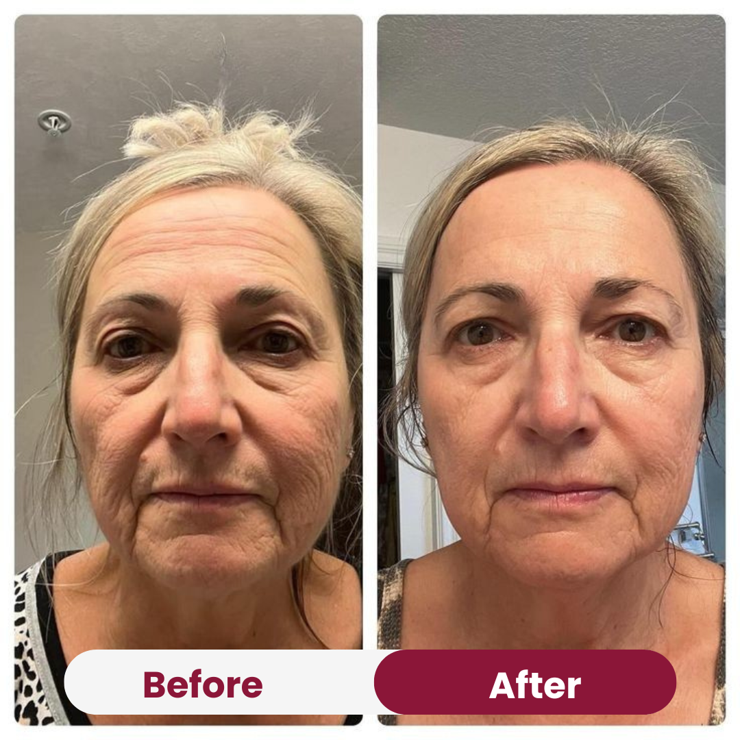 Salmon PDRN Collagen Mask