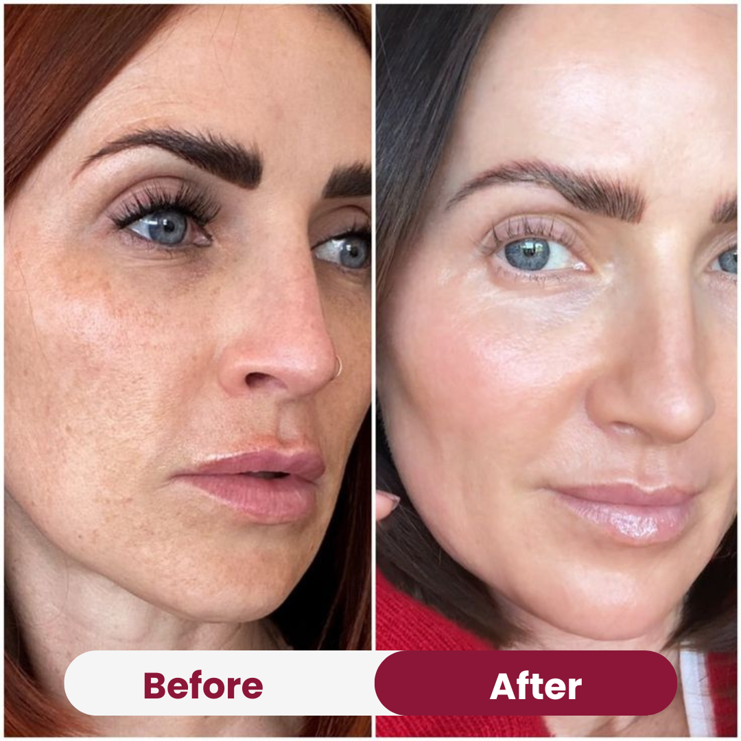 Salmon PDRN Collagen Mask